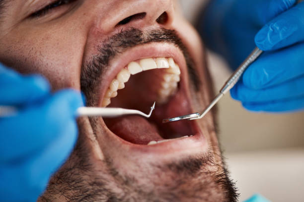 Best Urgent Tooth Repair  in Hudson, MI