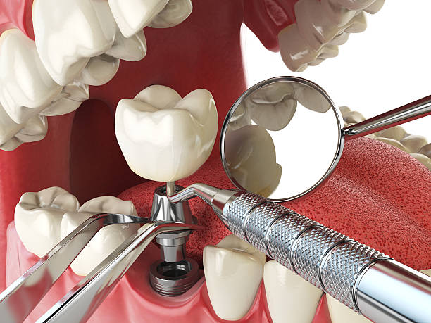 Best Emergency Dental Clinic in MI